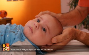 Plagiocéphalie traitement